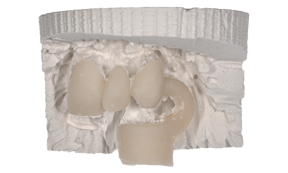 Celtra Press | Investment