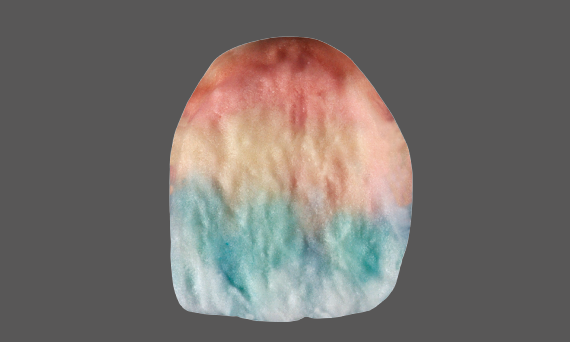 modeling image of an incisal tooth showing the Kiss ceramics concept