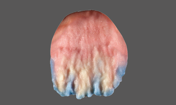 modeling image of an incisal tooth showing the Kiss ceramics concept