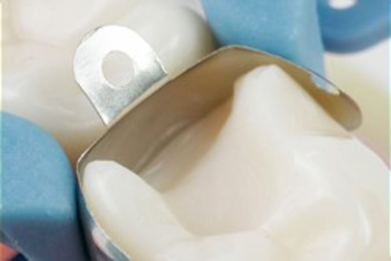 Clinical pictures wedges