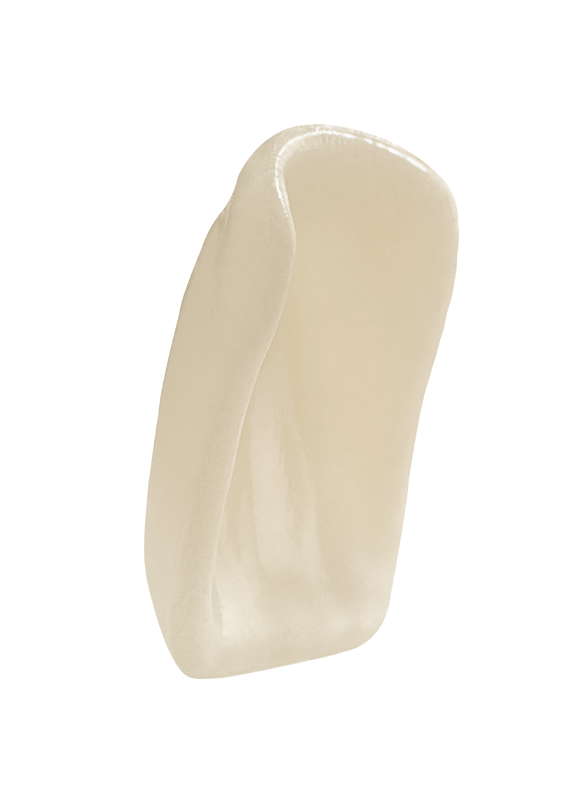 Dentsply Sirona Genios Veneers