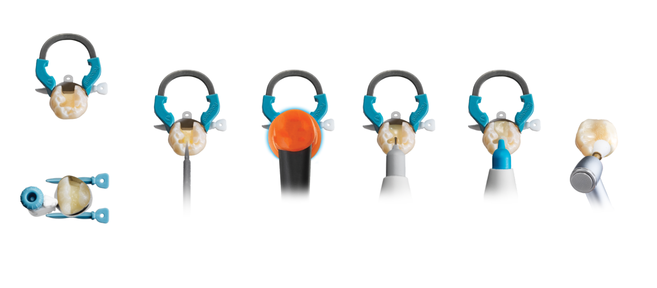 Class II Solution by Dentsply Sirona