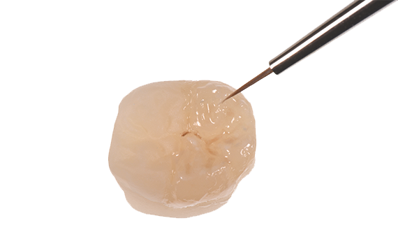 Celtra Press | Occlusal Staining