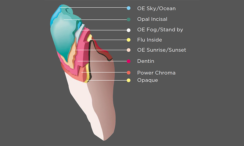 basic build-up technique in the anterior region with veneering porcelain;  Cercon ceram Kiss, Duceram Kiss, Duceragold Kiss