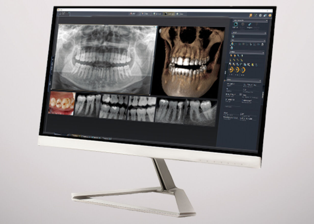 Intraoral Imaging